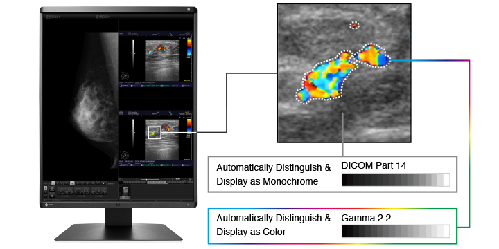 Monitor medyczny EIZO RadiForce RX560-BK